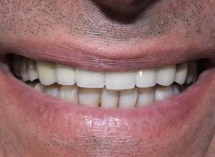 Patient before treatment