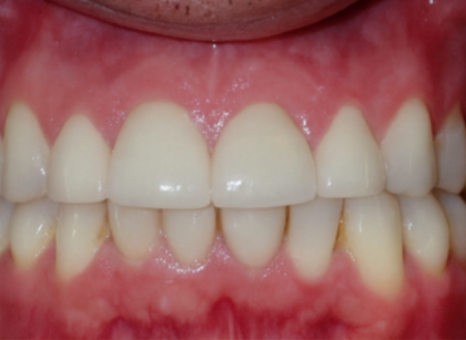 Patient before treatment