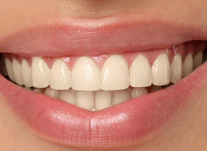 Patient before treatment