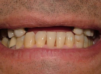 Patient after treatment
