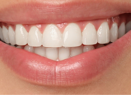 Patient after treatment