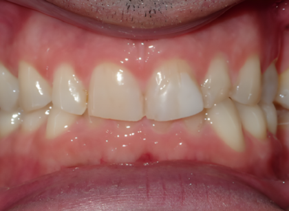 Patient after treatment